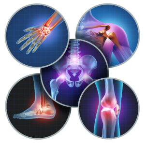 Personal Injury Lawyer Derry, NH - Human Painful Joints